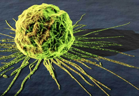 Šokující pravda o rakovině