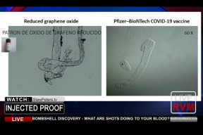co-covid-injekce-delaji-s-vasi-krvi-dr-jane-rubyova-prinasi-sokujici-objev-cz-dabing