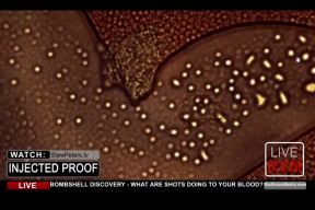 covid-injekce-pod-mikroskopem-nezname-castecky-v-krvi-ockovanych